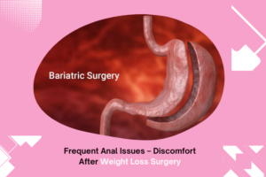Frequent Anal Issues – Discomfort After Weight Loss Surgery.