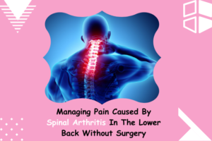Managing Pain Caused By Spinal Arthritis In The Lower Back Without Surgery.